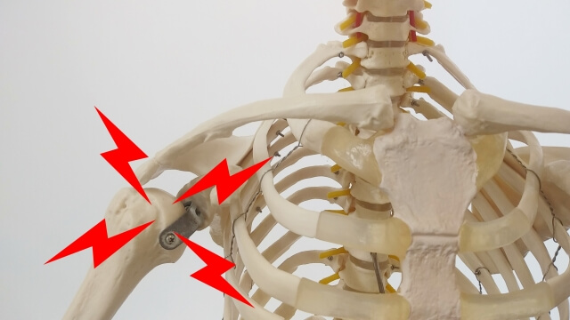 【四十肩の症状】四十肩以外に肩が痛む2つの原因