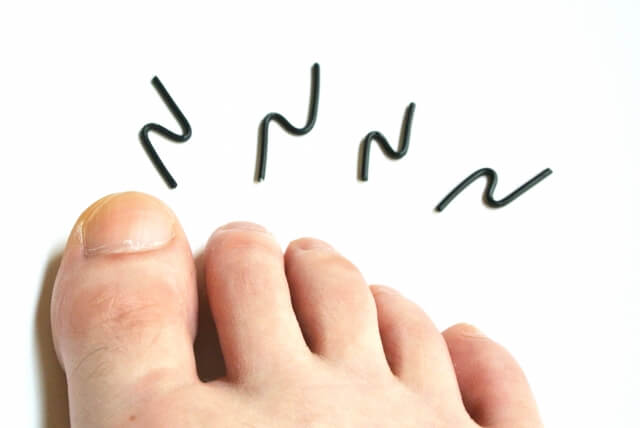 冬の痒~い「しもやけ」の治し方!どんな人がなりやすい?しもやけに効く市販薬も紹介