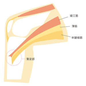 鵞足炎