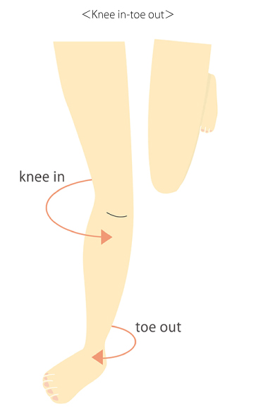 Knee in-toe out