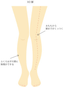 X脚 O脚を本気で矯正したい人向け 美脚 脚長を手に入れるストレッチの方法 株式会社テイコク製薬社